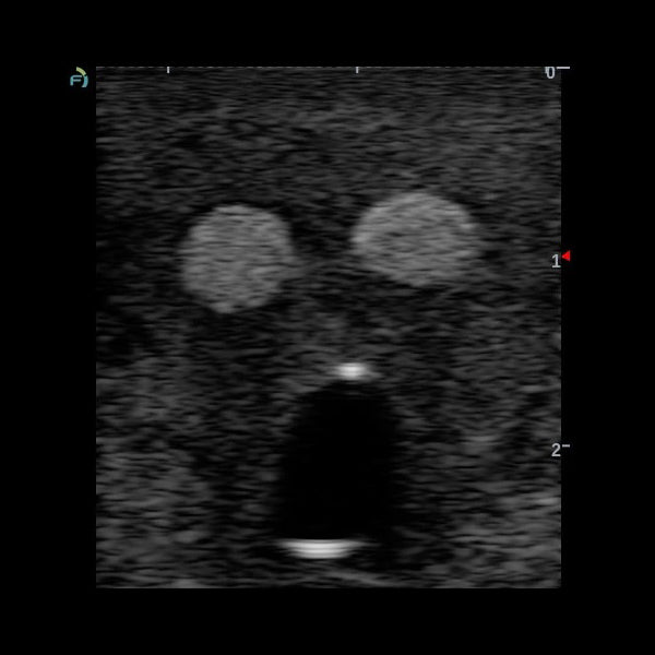 Fantôme échographie anesthésie 6 structures 17×13×4 cm - nerfs