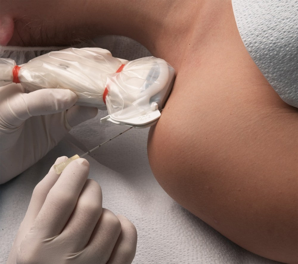 Pourquoi utiliser l’échographie lors de la mise en place des accès vasculaires ?
