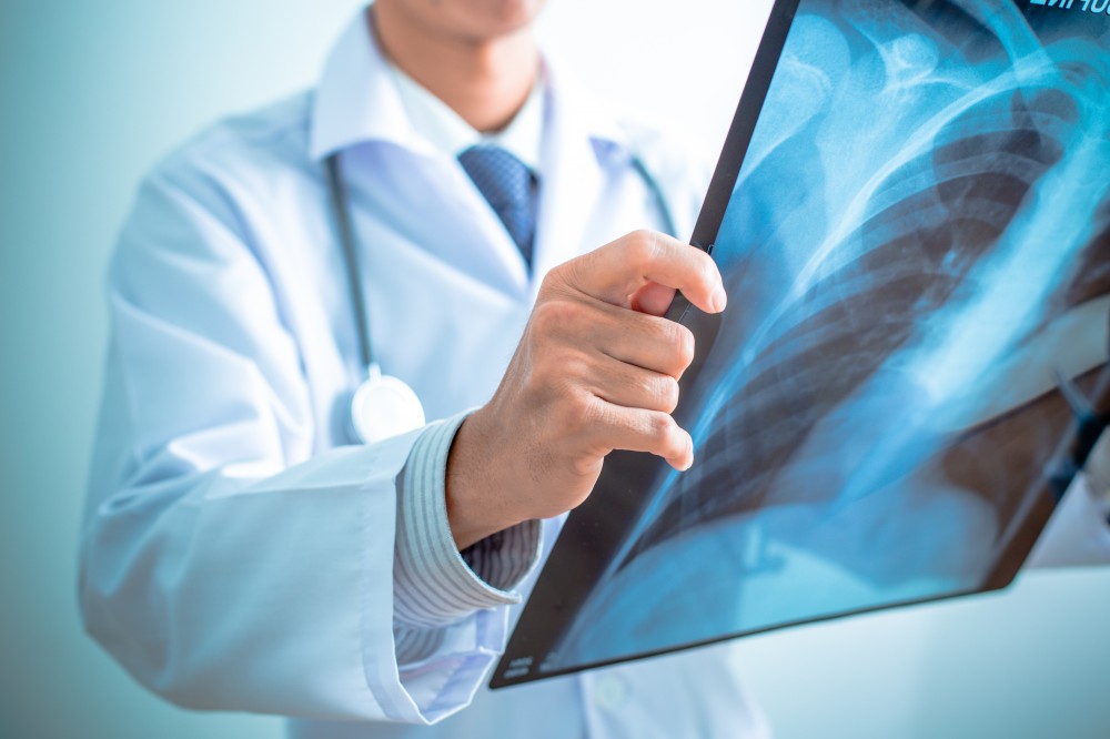 Qu'est ce que le DR (Direct Radiography) ?