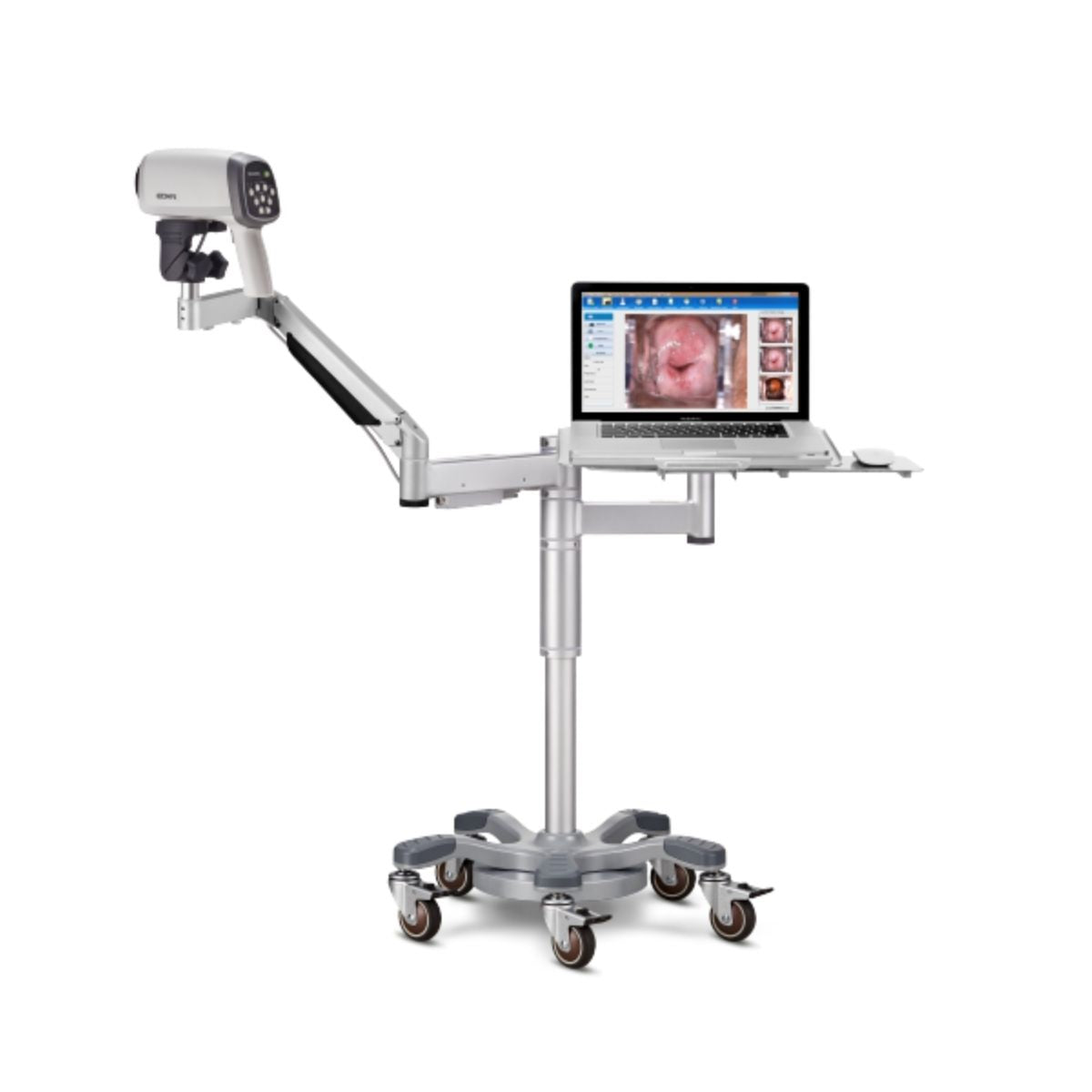 Colposcope C6A avec bras articulé et plateau pour PC