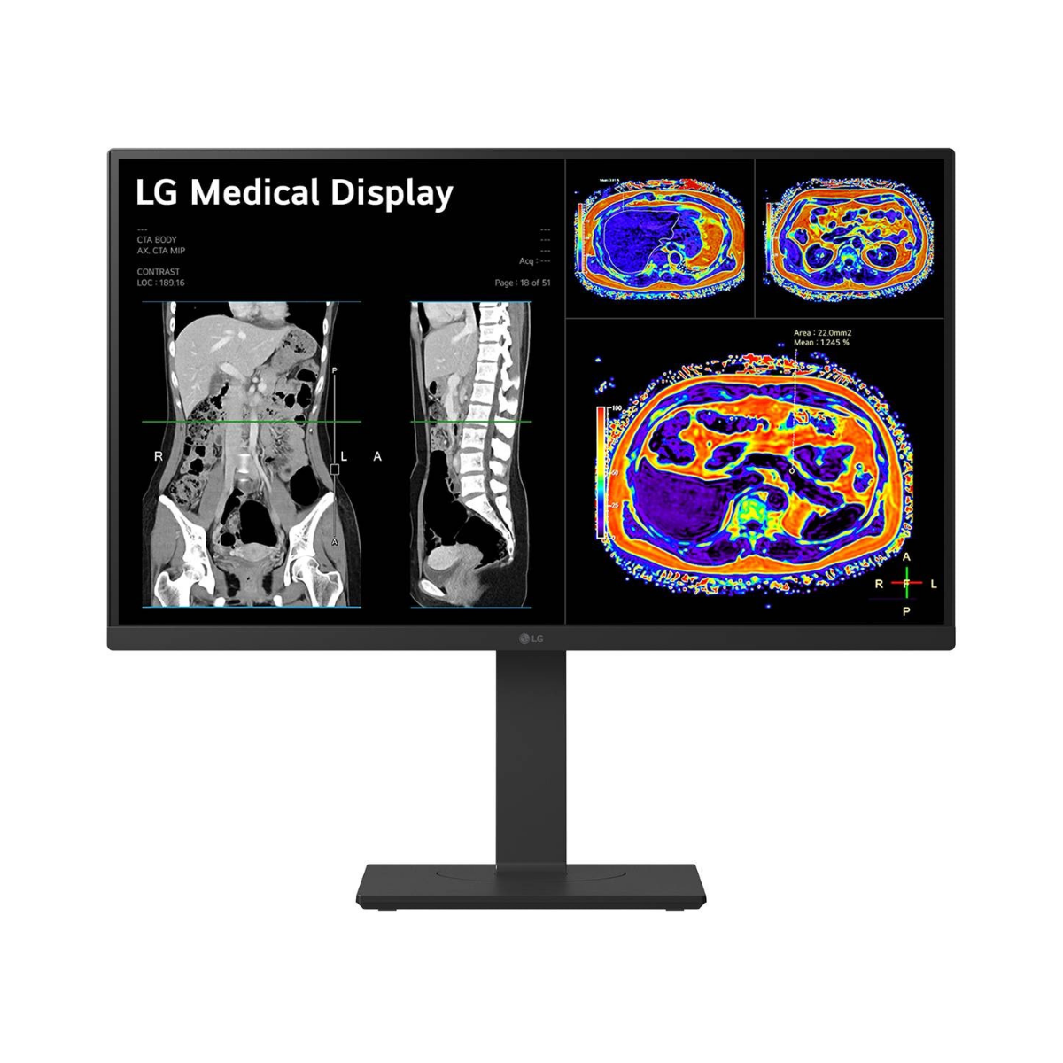 Moniteur de revue clinique LG 27HS713C 8MP 27 pouces, vue de face avec images DICOM