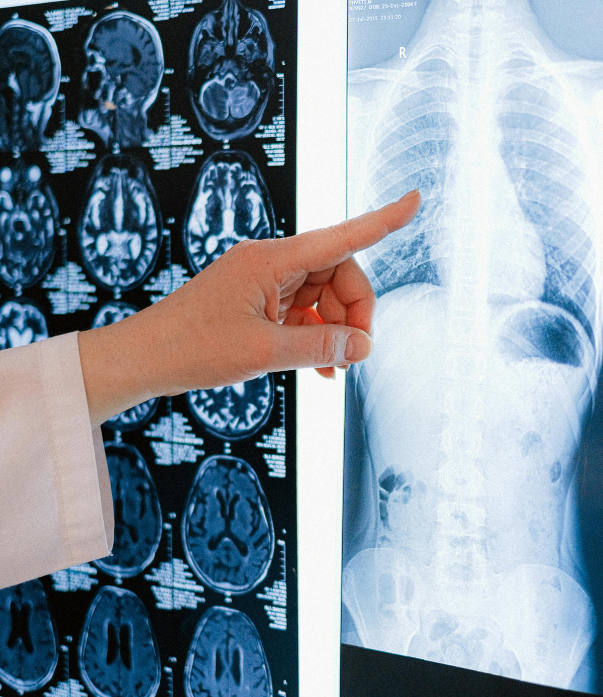 Matériel de radiologie imagerie médicale | EDM Imaging