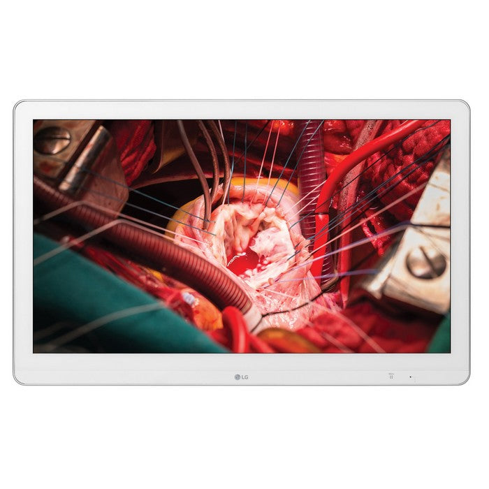 27HK510S-moniteur-chirurgie-fullhd