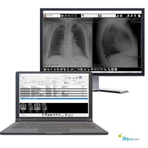 med_diag_laptop